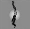 Get Rid of the Term Subluxation - Past Board Member of Arkansas Chiropractic Association. Get Rid of the Term Subluxation - Past Board Member of Arkansas Chiropractic Association.