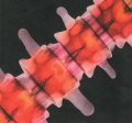 New Research Sheds Light on Chiropractic and Scoliosis New Research Sheds Light on Chiropractic and Scoliosis