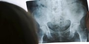 New Research Sheds Light on Chiropractic and X-ray New Research Sheds Light on Chiropractic and X-ray