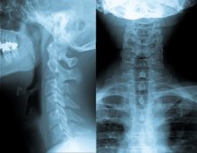 Defending the use of Routine X-Rays in Chiropractic Care: A Public Health Imperative Defending the use of Routine X-Rays in Chiropractic Care: A Public Health Imperative