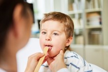 New Research on Sheds Light on Tonsillitis New Research on Sheds Light on Tonsillitis